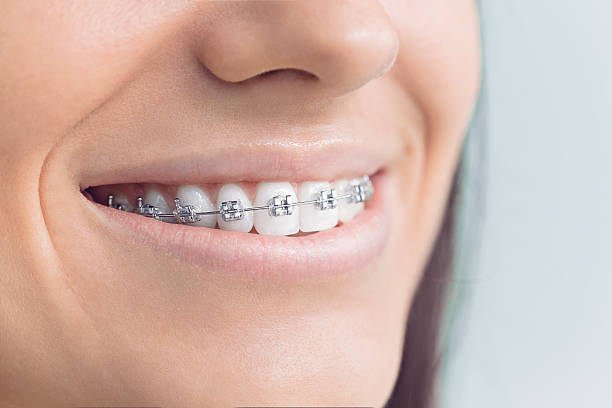 Best Wisdom Tooth Removal  in Freeman, SD